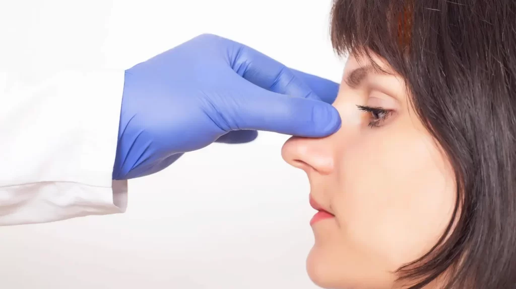 Nazal Valve Estetiği