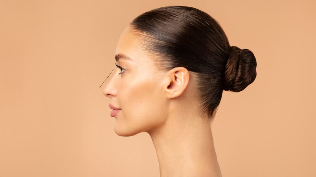 Revizyon Rinoplasti Ankara<