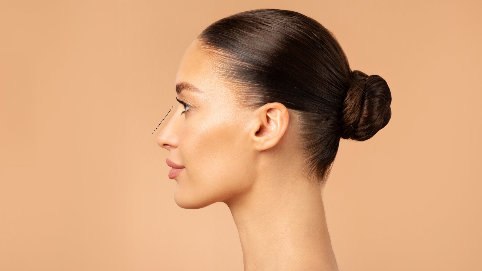 Revizyon Rinoplasti Ankara