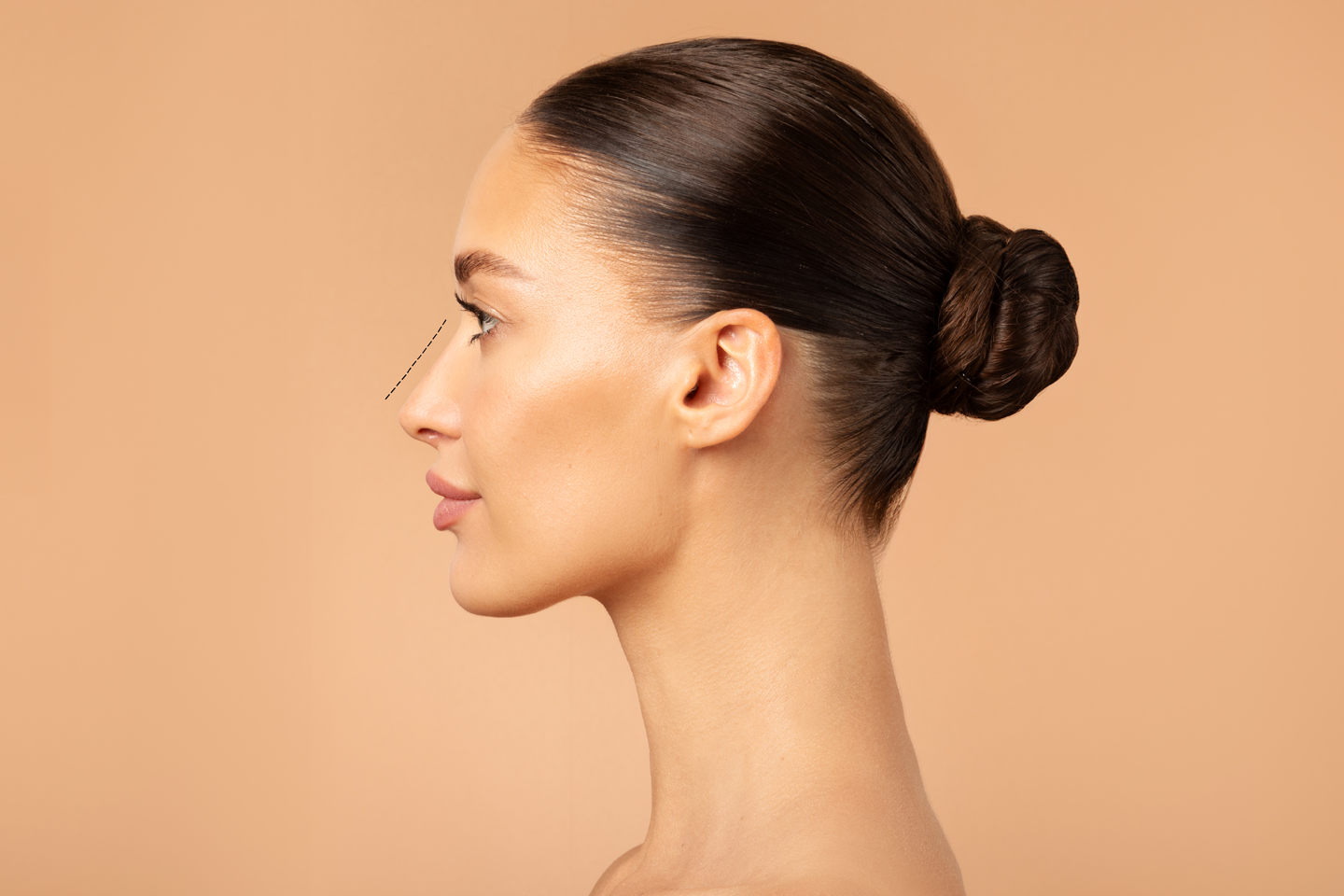 Burun Estetiği (Rinoplasti) Kalıcı mıdır?